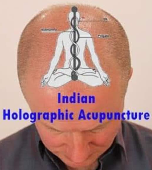 Scalp acupuncture treatment